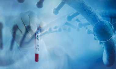 The Impact of Covid 19 on Pharma Sector